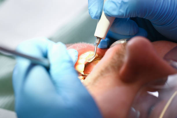 Best Emergency Broken Tooth Repair in Lowell, MI